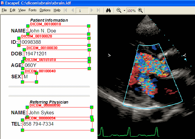 DICOM markup using RedTitan EscapeE