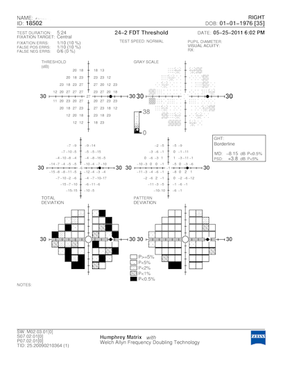 Visual field Test